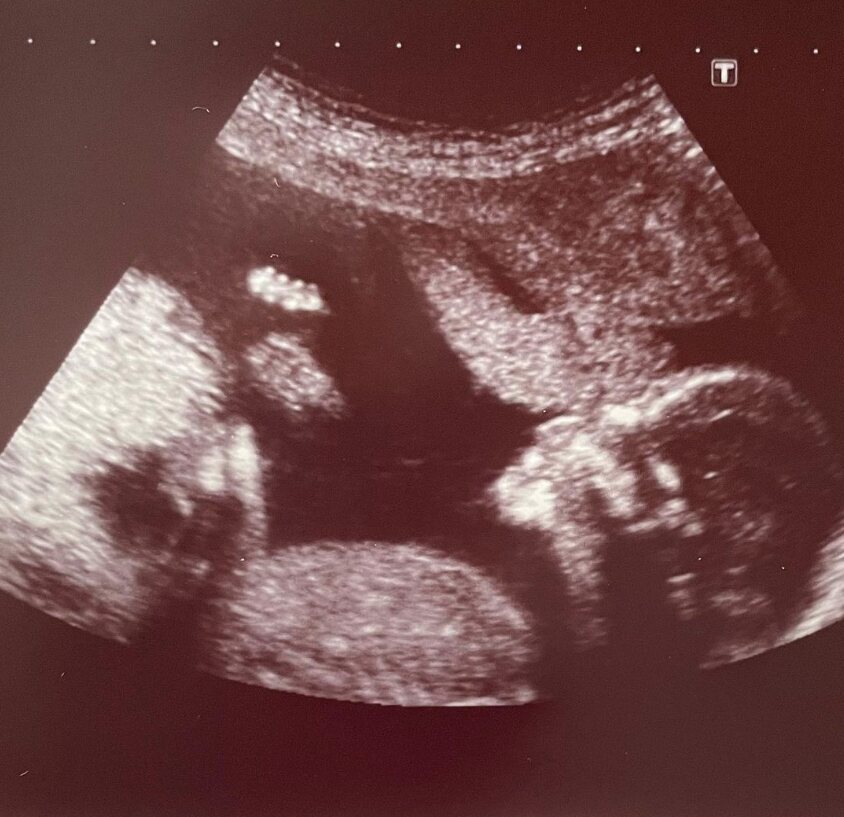 Edu Soto comparte la ecografía de su segunda hija/ Foto: Instagram