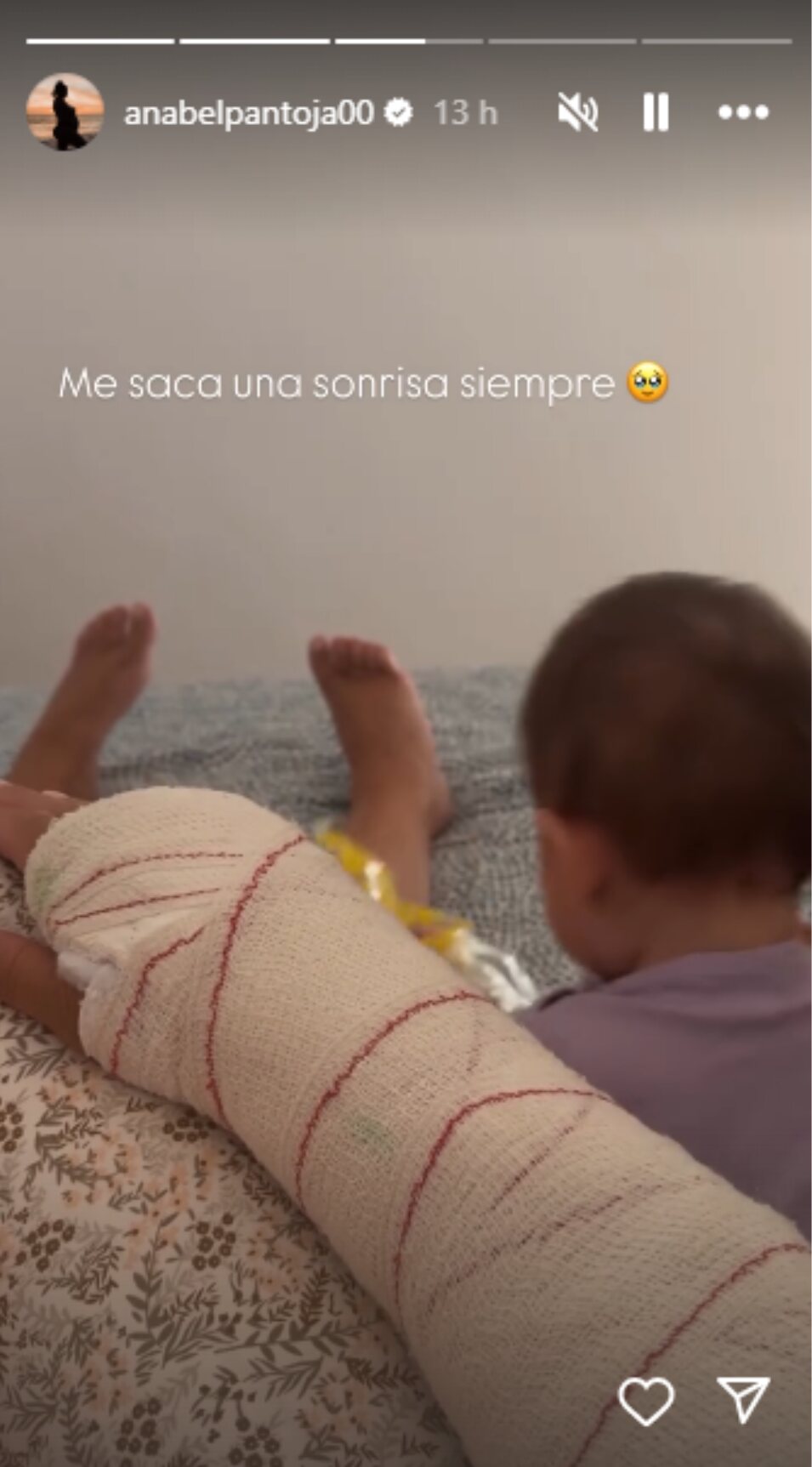 Anabel Pantoja junto a su hija mientras se recupera de su luxación de codo | Foto: Instagram