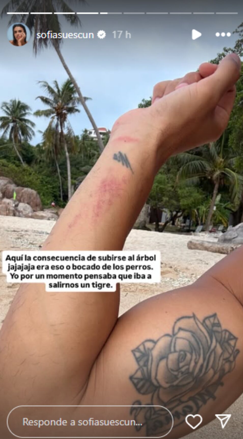 Kiko enseñando sus heridas a causa del ataque de los perros | Foto: Instagram