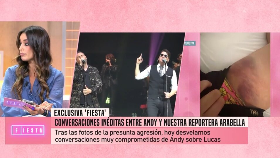 El hematoma de Andy | Foto: telecinco.es