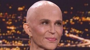 Antonia San Juan: "Lo que no quiero es convertirme en la imagen del cáncer"