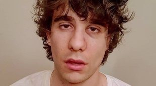 Javier Calvo muestra su rostro tras la agresión de Lisboa