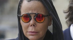 Las razones del accidente de nariz de Kalina de Bulgaria