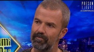 Pau Donés, en 'El Hormiguero': "Con el cáncer convivo, no lucho"