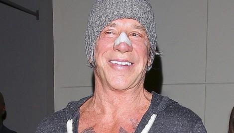Mickey Rourke con la nariz rota en Los Ángeles