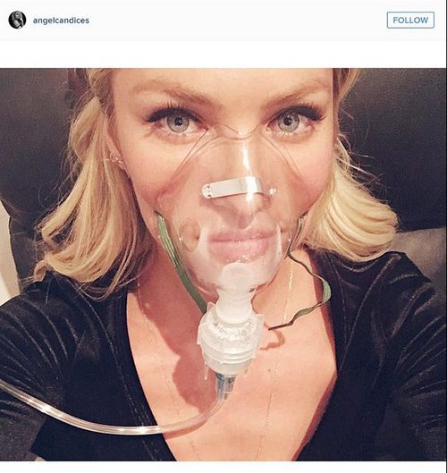Candice Swanepoel con máscara de oxígeno mala antes del desfile de Victoria's Secret 2015