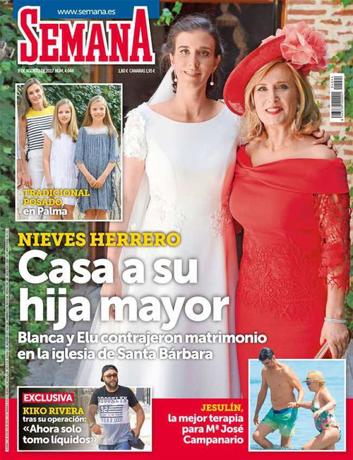 Kiko Rivera habla de su reducción de estómago en Semana