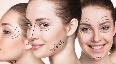 Lifting facial: ¿se puede operar el rostro por partes o hay que hacerlo todo al mismo tiempo?